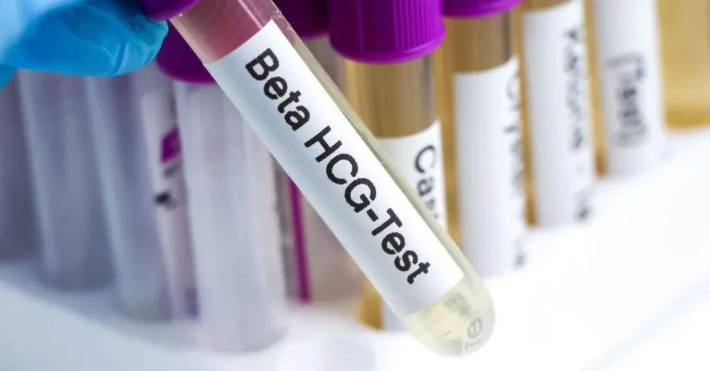 Gonadotropina kosmówkowa (hCG) - nawiązanie do roli hCG w trakcie terapii testosteronem