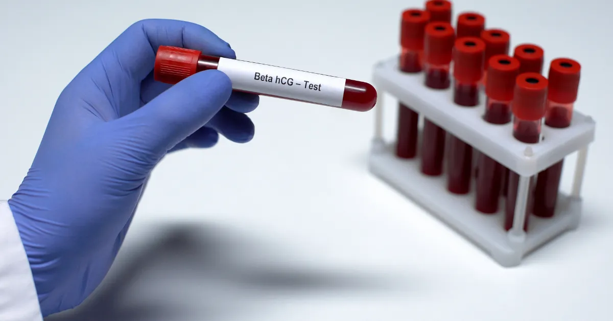 Próbówka z napisem "Beta hCG test" - nawiązanie do artykułu o działaniu hCG u mężczyzn