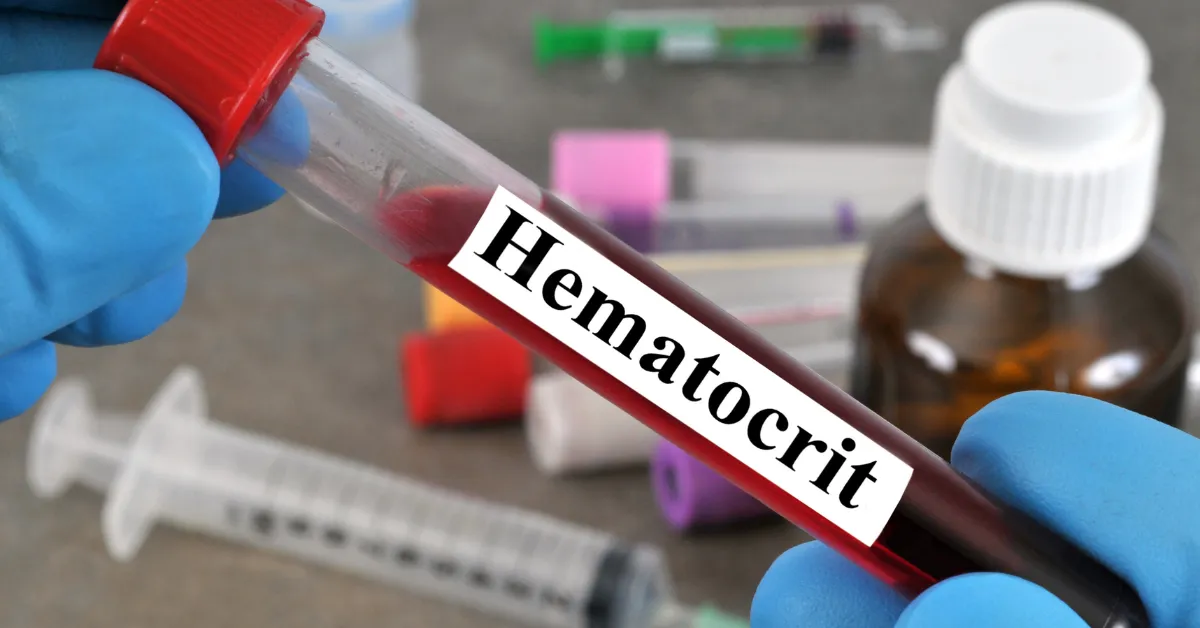 Próbówka krwi z napisem "hematokryt" - nawiązanie do gęstej krwii spowodowanej terapią TRT